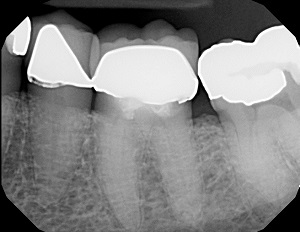 Leggi l'articolo Dentaltown pubblica un richiamo di 70 anni