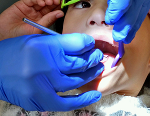 Leggi l'articolo PULPDENT sostiene i bambini bisognosi di cure dentistiche