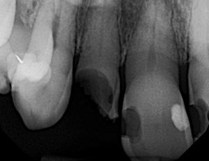 Leggi l'articolo Odontoiatria eroica: Salvare la giornata a Judy