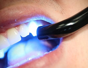 Leggi l'articolo Fare luce sui LEDS