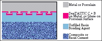 Bonding-to-Porcelain-and-Dental-Alloys