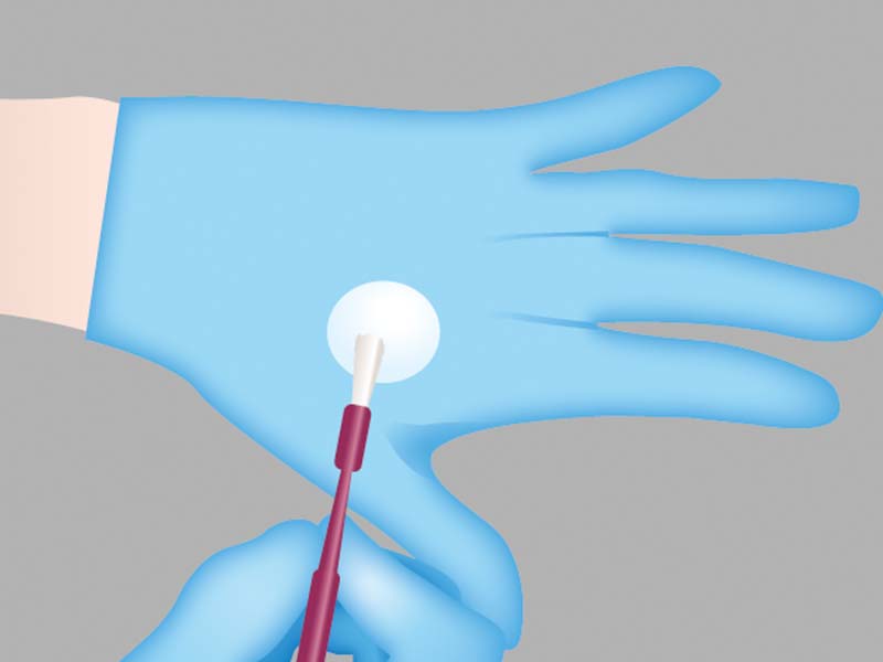 clinical-procedure-embrace-varnish-3