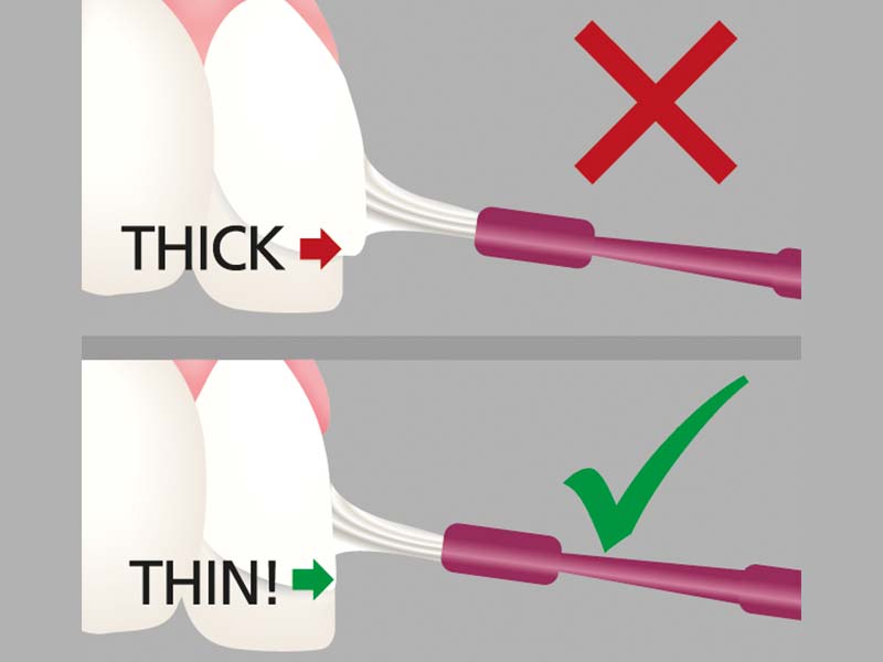 clinical-procedure-embrace-varnish-4