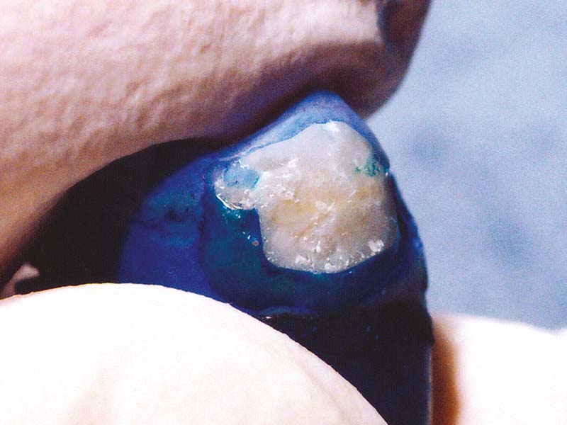 clinical-procedure-ortho-coat-3
