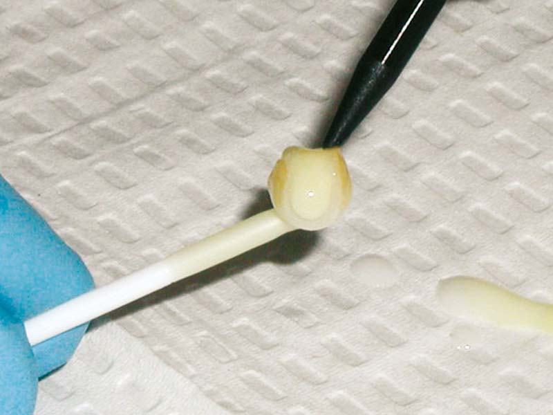 clinical-procedure-pic-n-stic-1