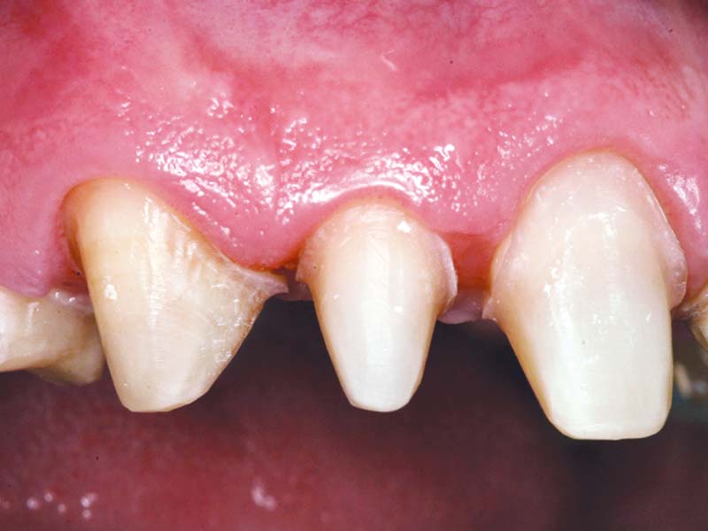 clinical-procedure1-tuff-temp-plus-6