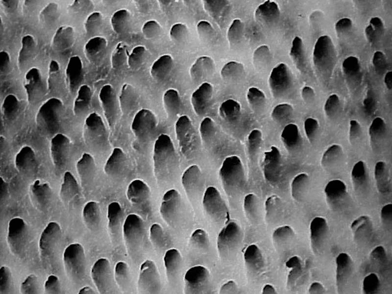 etch-rite-fig2