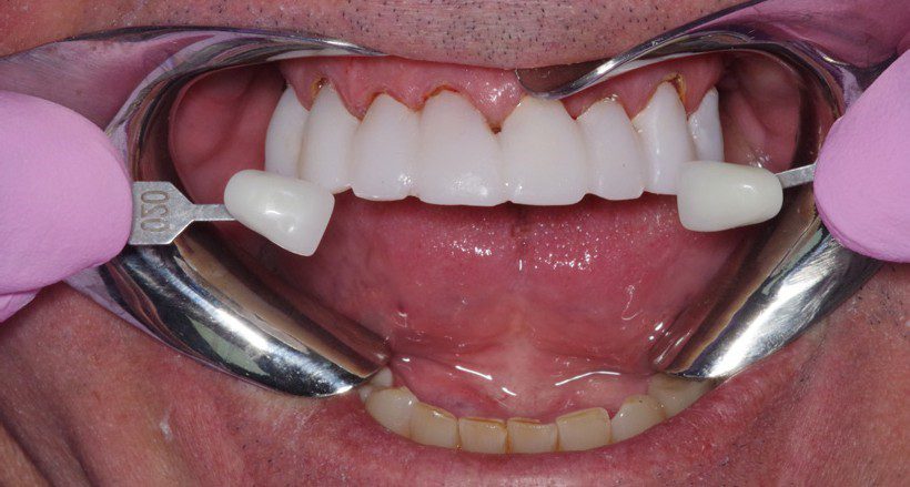 Leggi l'articolo Nuovo eBook: Come realizzare temporizzatori durevoli ed estetici